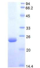 Figure 2. SDS-PAGE