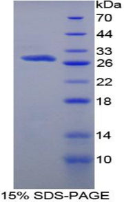 Figure 1. SDS-PAGE