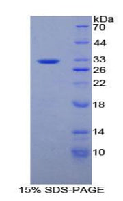 Figure 1. SDS-PAGE