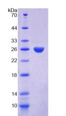 Figure 2. SDS-PAGE
