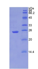 Figure 2. SDS-PAGE
