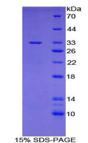 Figure 1. SDS-PAGE