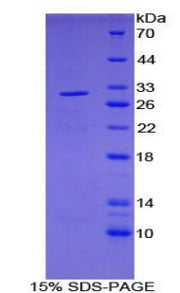 Figure 1. SDS-PAGE