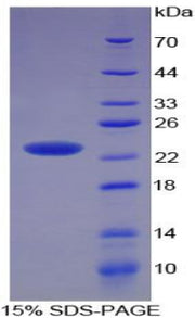 Figure 1. SDS-PAGE
