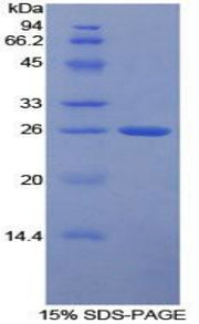 Figure 1. SDS-PAGE