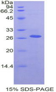 Figure 1. SDS-PAGE