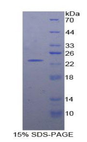 Figure 1. SDS-PAGE
