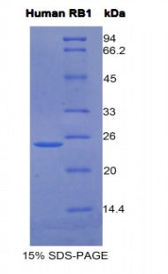 Figure 1. SDS-PAGE