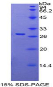 Figure 1. SDS-PAGE