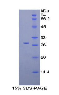 Figure 1. SDS-PAGE