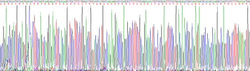 Recombinant Human Retinol Binding Protein 4 (RBP4)