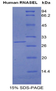 Figure 1. SDS-PAGE