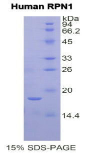Figure 1. SDS-PAGE