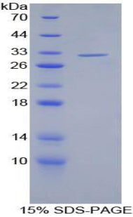 Figure 1. SDS-PAGE