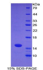Figure 1. SDS-PAGE