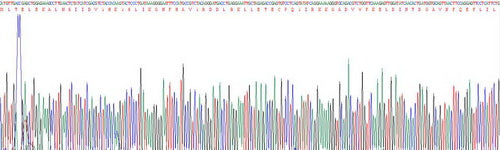 Recombinant Human S100 Calcium Binding Protein A8 (S100A8)