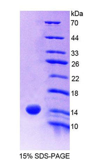 Figure 1. SDS-PAGE