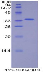 Figure 1. SDS-PAGE