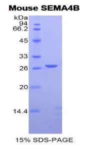 Figure 1. SDS-PAGE
