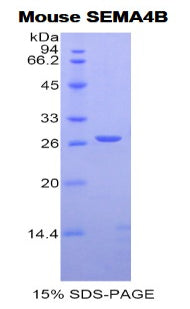 Figure 1. SDS-PAGE