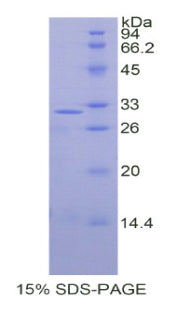 Figure 1. SDS-PAGE