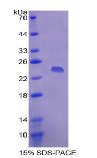 Figure 1. SDS-PAGE