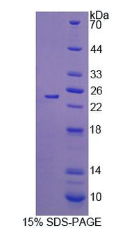 Figure 1. SDS-PAGE