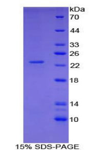 Figure 1. SDS-PAGE