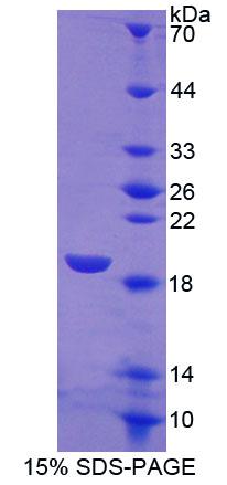 Figure 1. SDS-PAGE