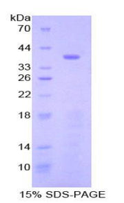 Figure 1. SDS-PAGE