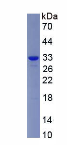 Figure 1. SDS-PAGE