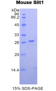 Figure 1. SDS-PAGE