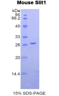Figure 1. SDS-PAGE