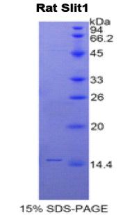 Figure 1. SDS-PAGE