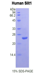 Figure 1. SDS-PAGE