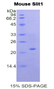 Figure 1. SDS-PAGE