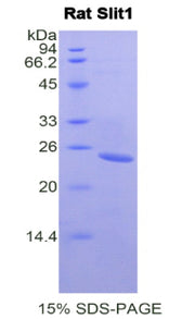 Figure 1. SDS-PAGE