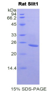 Figure 1. SDS-PAGE