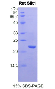 Figure 1. SDS-PAGE