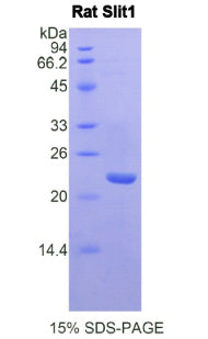 Figure 1. SDS-PAGE