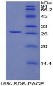 Figure 1. SDS-PAGE
