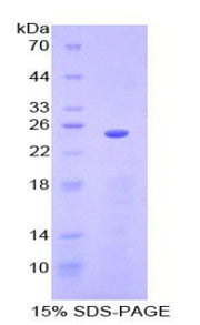 Figure 1. SDS-PAGE