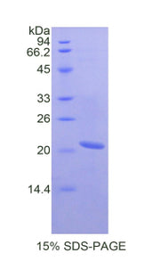 Figure 1. SDS-PAGE