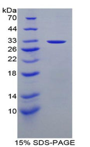 Figure 1. SDS-PAGE