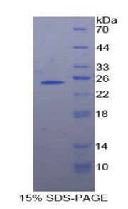 Figure 1. SDS-PAGE