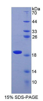 Figure 1. SDS-PAGE