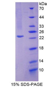 Figure 1. SDS-PAGE