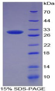 Figure 1. SDS-PAGE