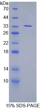 Figure 1. SDS-PAGE