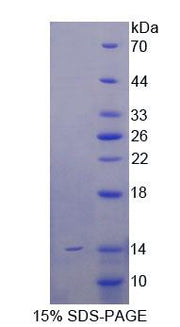 Figure 1. SDS-PAGE